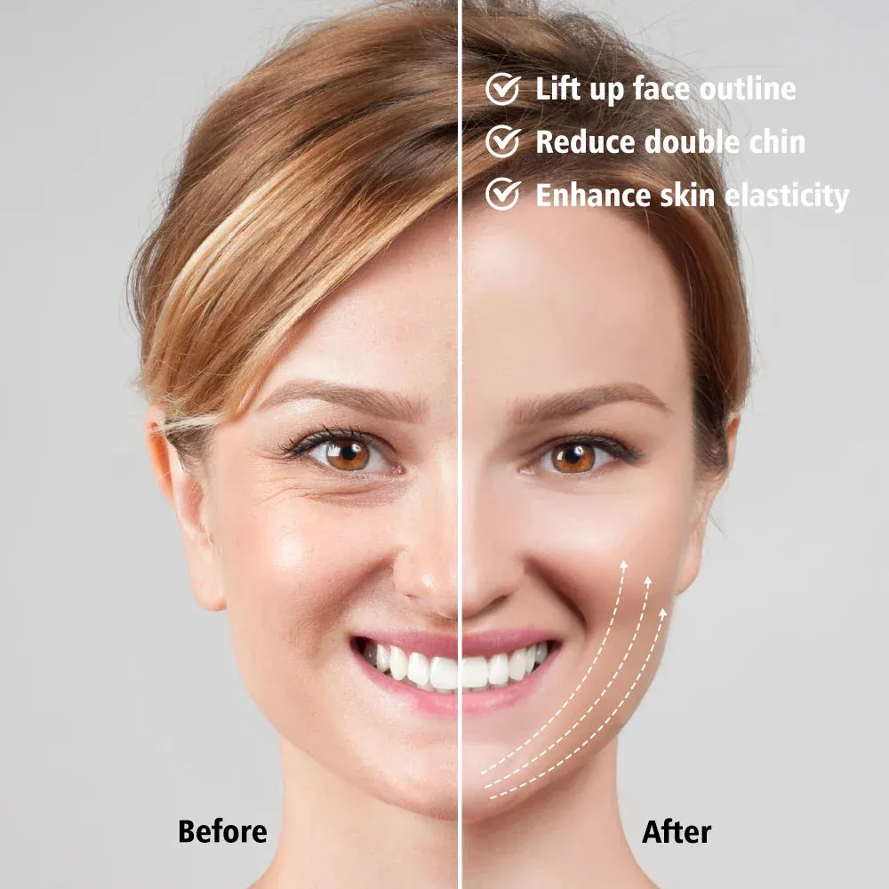 Electric v Face Massager for Slimming and Lifting