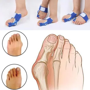 Orthopedic Bunion Corrector Device Hallux Valgus Toe Correction Pedicure  Legs Thumb Foot Massage Foot Care Tools