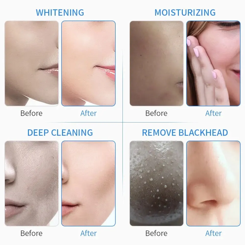 Spa Facial Hydro Dermabrasion Machine 6 in 1